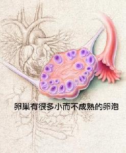 卵巢癌晚期死前症状!